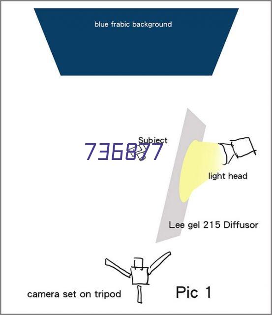 天喜高压电位治疗仪(1个月)